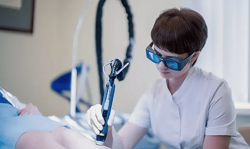 Tratamento de varizes veias com um laser