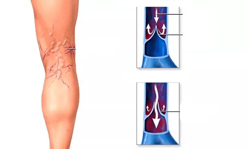 movimento sanguíneo