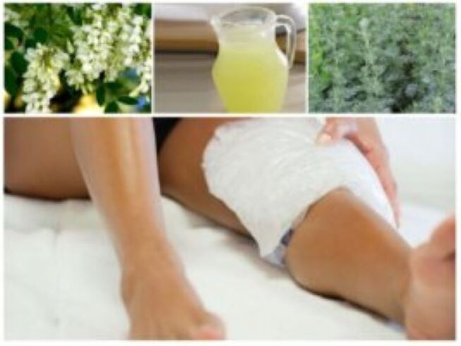 Um método popular muito eficaz para o tratamento de varizes é o uso de compressas.