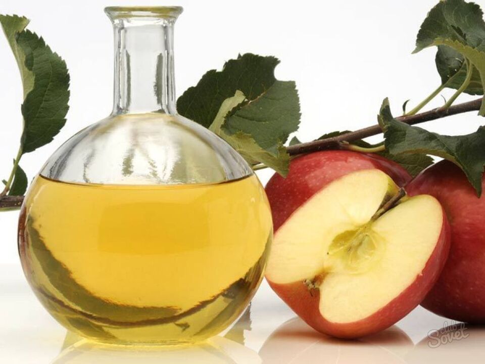 vinagre de maçã para varizes